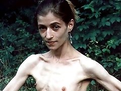 anorexic girls