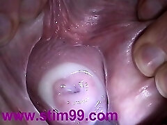 Insertion Jelly in Cervix Pussy Butt-plug. Cum in Uterus