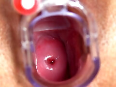 Nurse Greta shows her womb