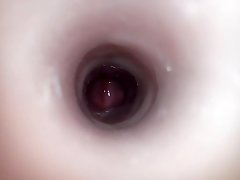 L'intérieur de l'anus
