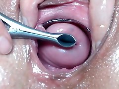 Wideo open cervix