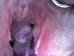 Cum Injection with Syringe in Cervix Uterus after Drilling
