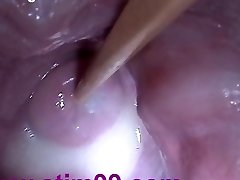 Insertion Semen Cum in Cervix Wide Stretching Pussy Buttplug