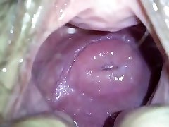 my japanese girlfend's uber-cute cervix in massive hole