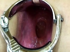 Elmer wife extreme anal speculum have fun