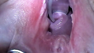 Extreme Anal Fisting, Huge Objects, Cervix Insertion, Peehole Fucking, Nettles, Electro Orgasms an.