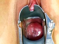 beautiful and creamy pink cervix through a metal speculum