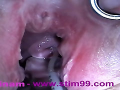 Extreme Anal Fisting, Huge Objects, Cervix Insertion, kooking aunty Fucking, Nettles, Electro Orgasms and Saline Injection