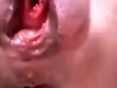 Mature With The Most Extreme Peehole Insertion And A Pussy And Anal Gape
