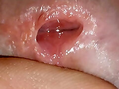 Preparing the lady for injection of the tube with the anesthetic serum.